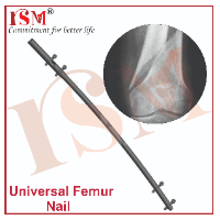 Universal Femur Nail