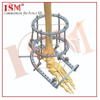 External Fixator System