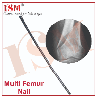 Multi Femur Nail 