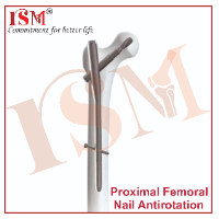 Proximal Femoral Nail Antirotation (PFNA)