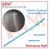 Humerus Nail 