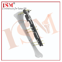 Rail Fixator System