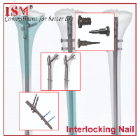 Interlocking Nails